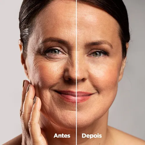 Rosa Amazônica Com Até 70% de Desconto 11 Antes x Depois Rosa Mosqueta