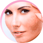 Rosa Amazônica Com Até 70% de Desconto 8 b5