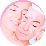 Rosa Amazônica Com Até 70% de Desconto 9 b6